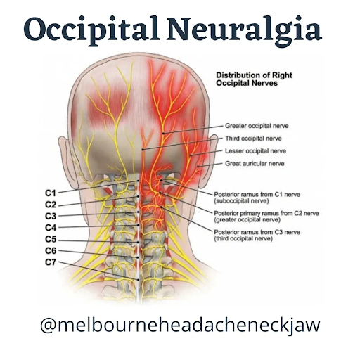 Nerve Pathways and Headache Triggers