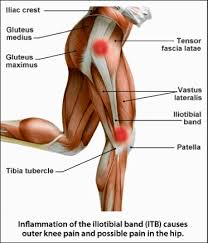 IT Band Syndrome-Running Injuries